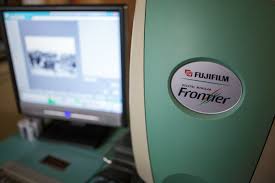 35mm Film Processing Frontier Scans